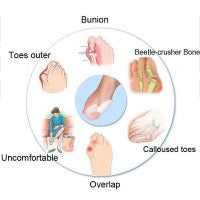 Corrector de Juanetes de Silicona con Separador y Protector para los Dedos
