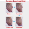 Corrector de Juanetes de Silicona con Separador y Protector para los Dedos
